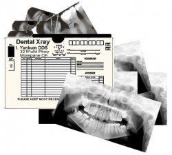 Dental Xray Set