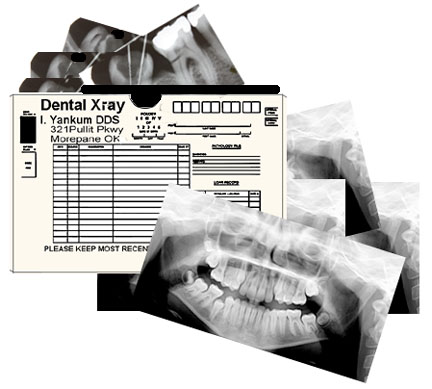 Dental Xray Set - Click Image to Close